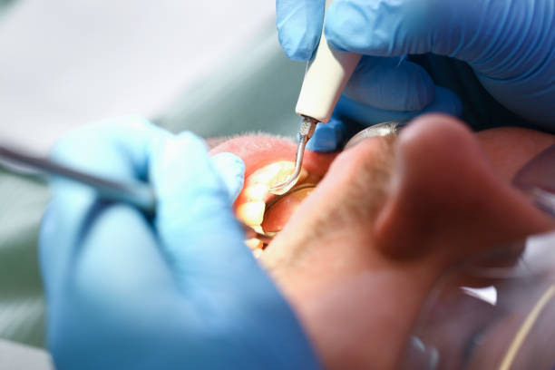 Best Walk-In Emergency Dentist in Drexel, OH